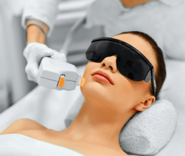 Photo of laser treatment