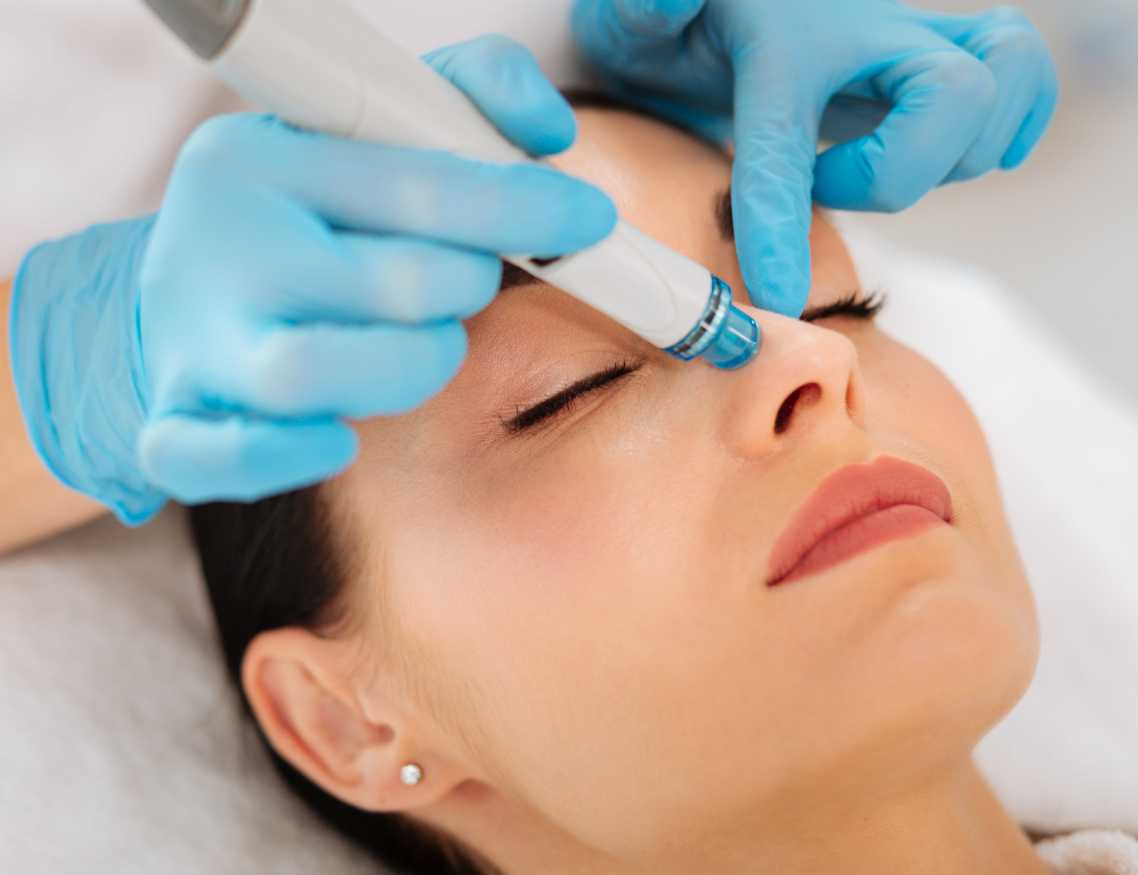 Hydra Facial treatment